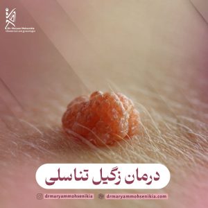 درمان زگیل تناسلی