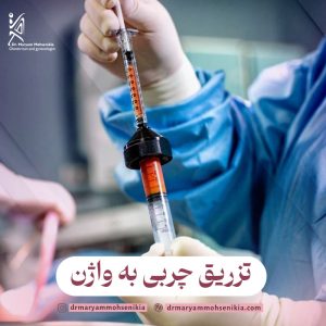 تزریق چربی به واژن