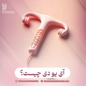 آی یو دی چیست؟