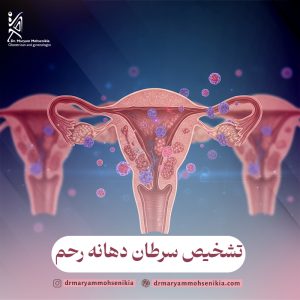 تشخیص سرطان دهانه رحم