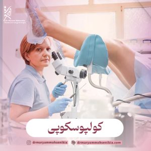 کولپوسکوپی