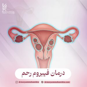 درمان فیبروم رحم