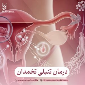 درمان تنبلی تخمدان
