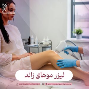 لیزر موهای زائد
