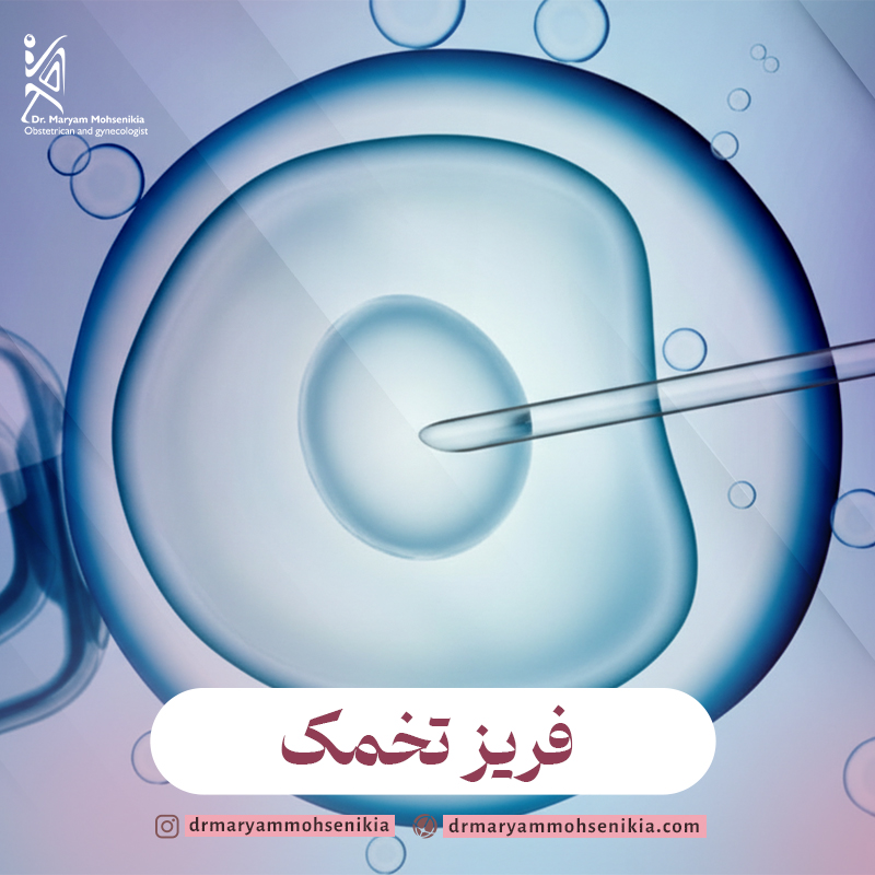 مراحل اجرایی برای فریز کردن تخمک