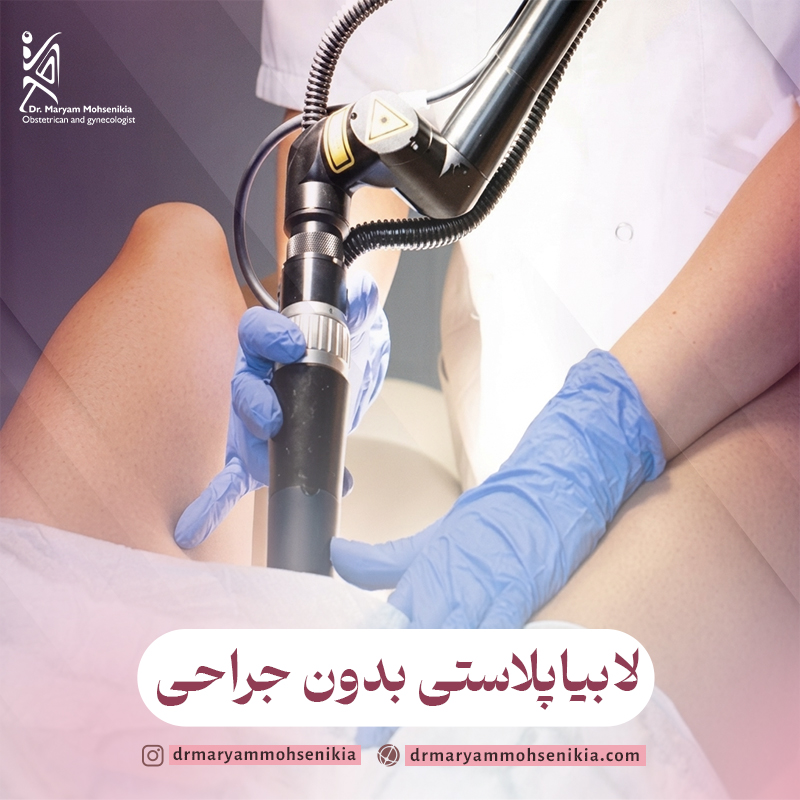 لابیاپلاستی بدون جراحی